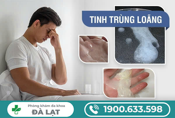 Hình ảnh minh họa
